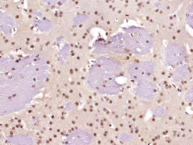 Neurogenic locus notch homolog protein 1 Antibody in Immunohistochemistry (Paraffin) (IHC (P))