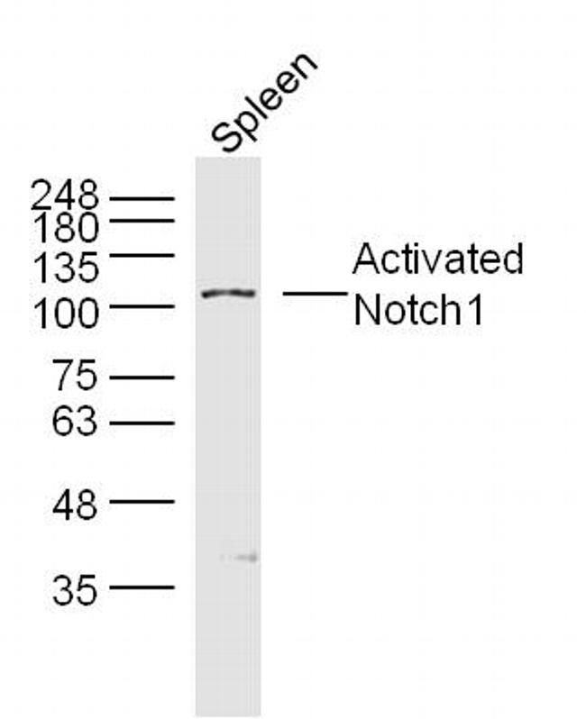 Neurogenic locus notch homolog protein 1 Antibody in Western Blot (WB)