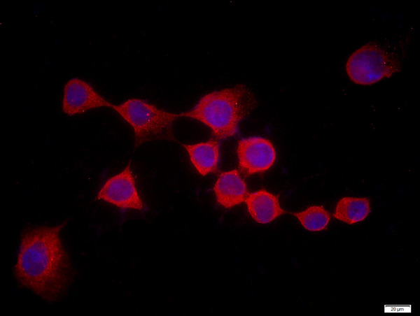 Rad51 Antibody in Immunocytochemistry (ICC/IF)