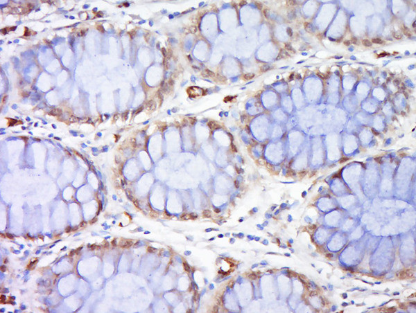 Rad51 Antibody in Immunohistochemistry (Paraffin) (IHC (P))