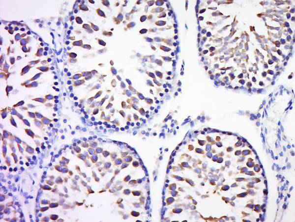 Rad51 Antibody in Immunohistochemistry (Paraffin) (IHC (P))