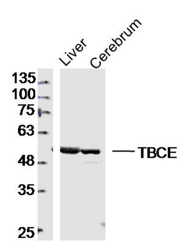 TBCE Antibody in Western Blot (WB)