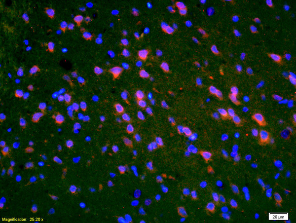 PMP2 Antibody in Immunohistochemistry (Paraffin) (IHC (P))