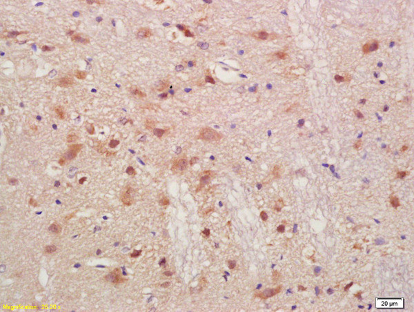 PMP2 Antibody in Immunohistochemistry (Paraffin) (IHC (P))