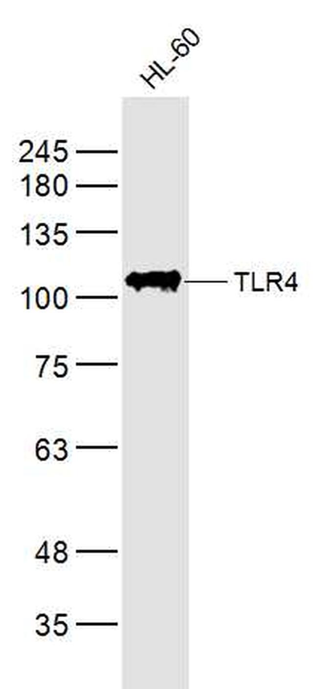 TLR4 Antibody in Western Blot (WB)