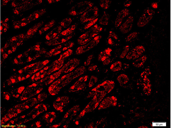 CD34 Antibody in Immunohistochemistry (Paraffin) (IHC (P))