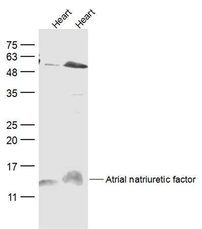 ANP Antibody in Western Blot (WB)