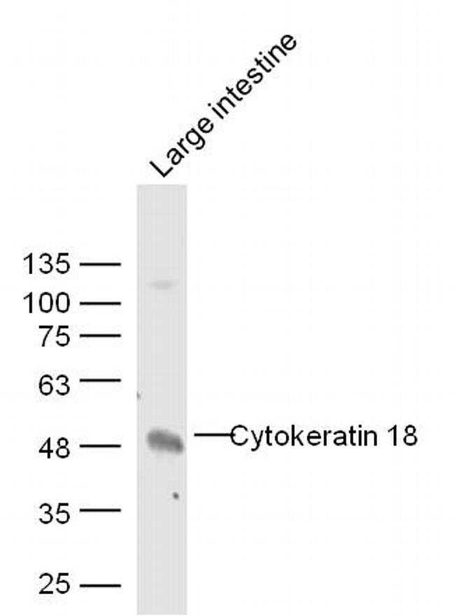 CK18 Antibody in Western Blot (WB)