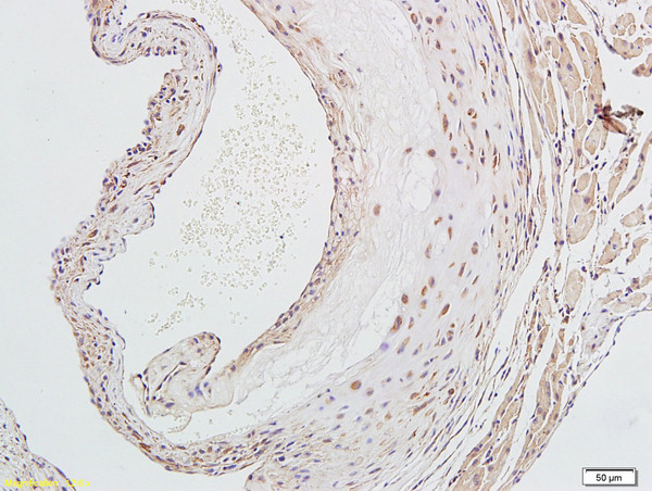 LOX 1 Antibody in Immunohistochemistry (Paraffin) (IHC (P))