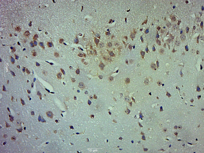 LOX 1 Antibody in Immunohistochemistry (Paraffin) (IHC (P))