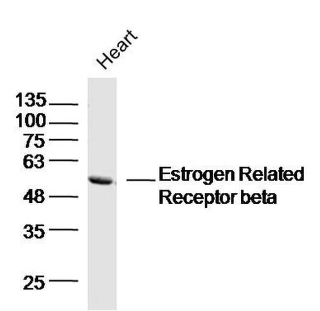 Estrogen Related Receptor beta Antibody in Western Blot (WB)