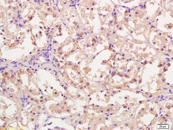 CPT1A Antibody in Immunohistochemistry (Paraffin) (IHC (P))