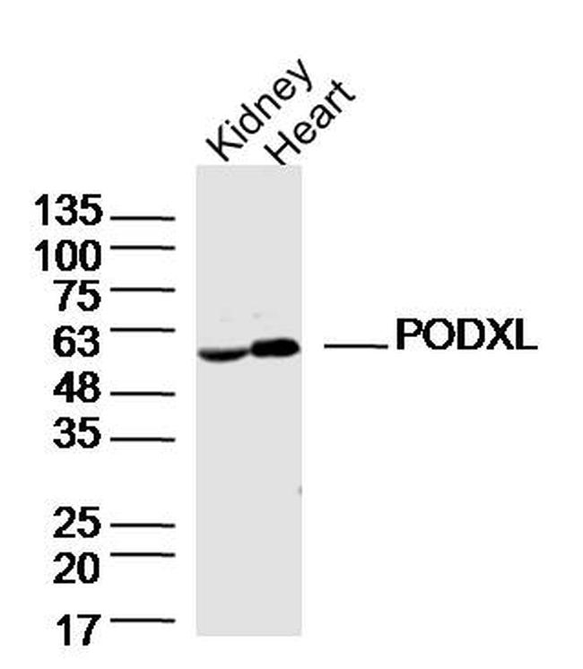 PODXL Antibody in Western Blot (WB)