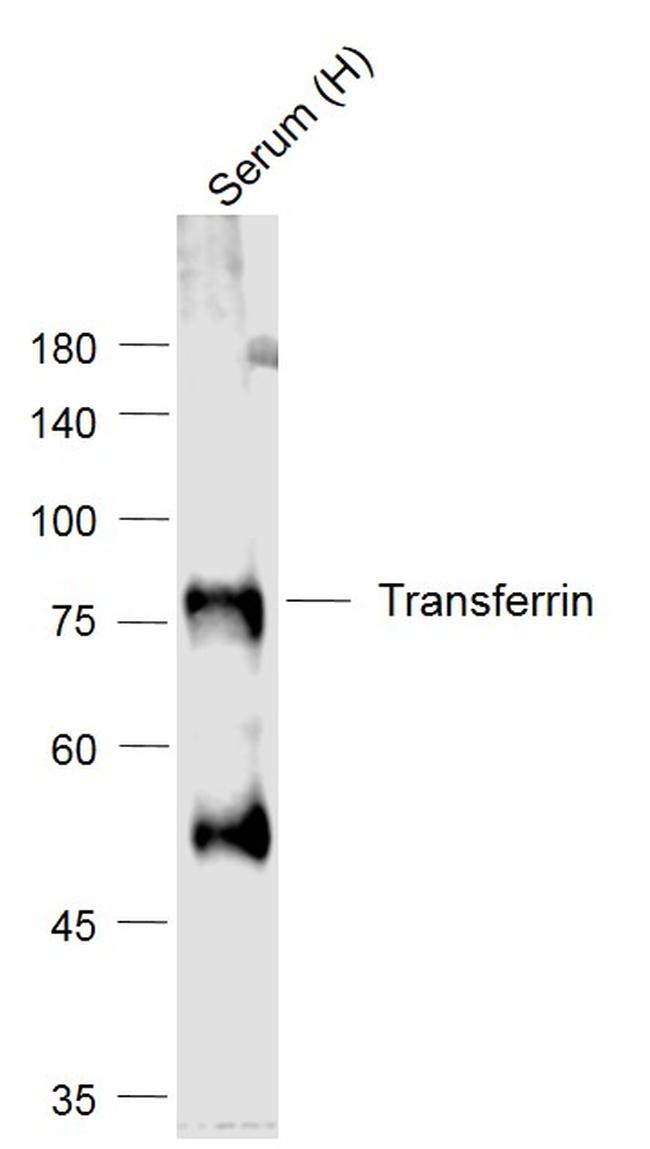 Transferrin Antibody in Western Blot (WB)