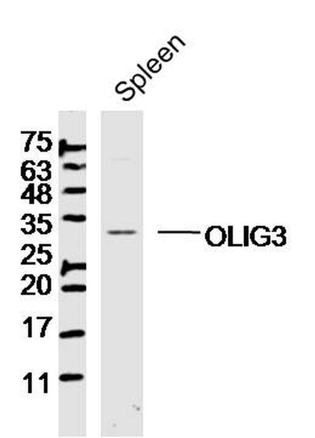 OLIG3 Antibody in Western Blot (WB)