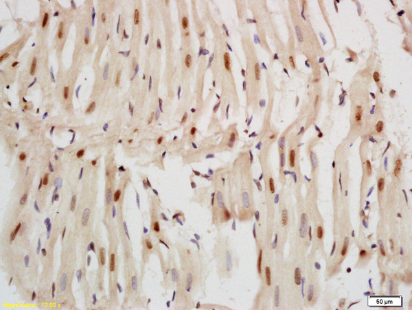 Nkx2.5/Cardiac-specic homeobox 1 Antibody in Immunohistochemistry (Paraffin) (IHC (P))