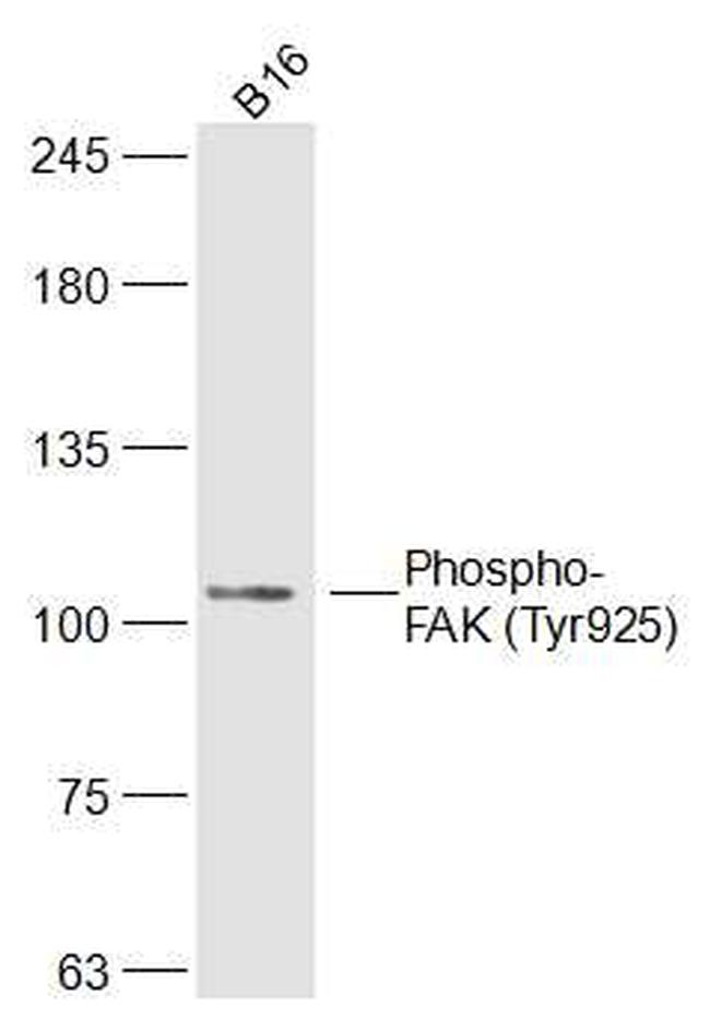 Phospho-FAK (Tyr925) Antibody in Western Blot (WB)