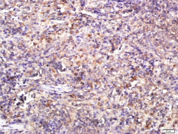 TLR4 Antibody in Immunohistochemistry (Paraffin) (IHC (P))