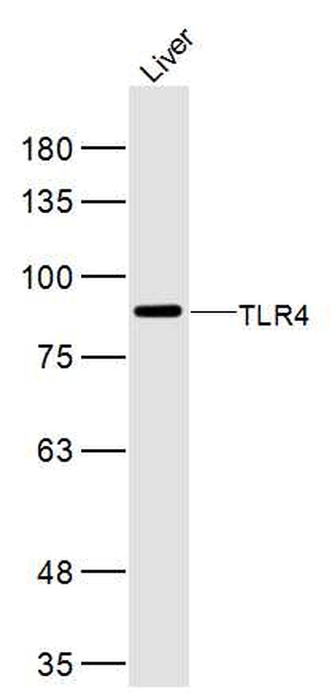 TLR4 Antibody in Western Blot (WB)