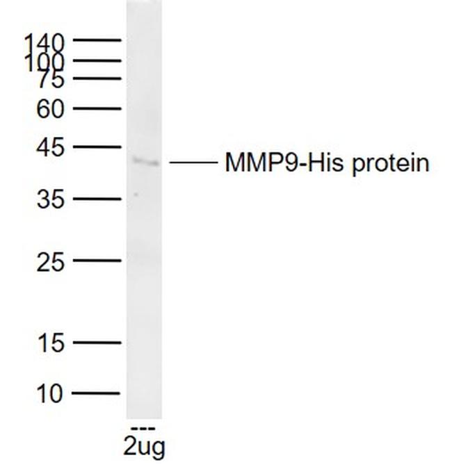 MMP9 Antibody in Western Blot (WB)