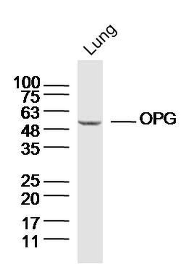 OPG Antibody in Western Blot (WB)