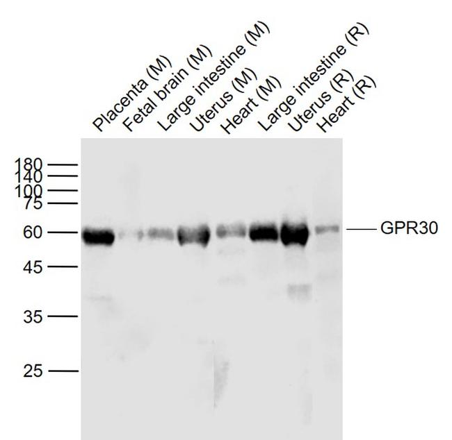 GPR30 Antibody in Western Blot (WB)