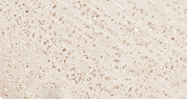 GPR30 Antibody in Immunohistochemistry (Paraffin) (IHC (P))