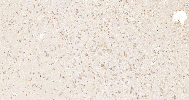 GPR30 Antibody in Immunohistochemistry (Paraffin) (IHC (P))