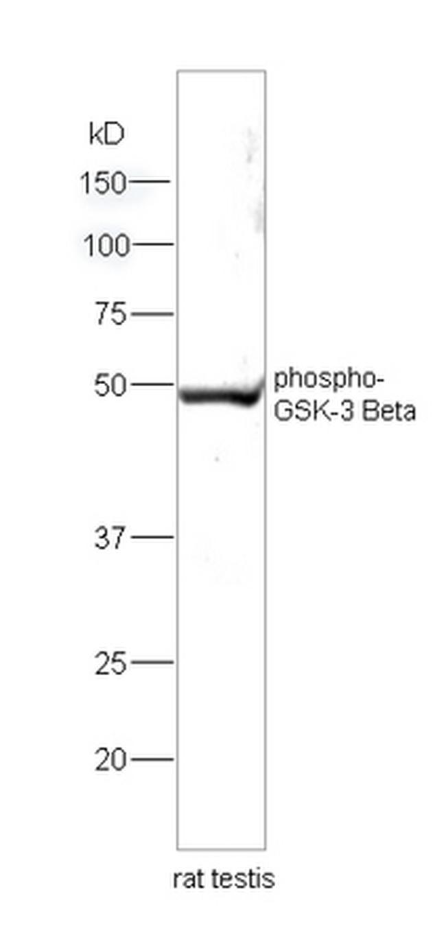 Phospho-GSK-3 Beta (Ser9) Antibody in Western Blot (WB)