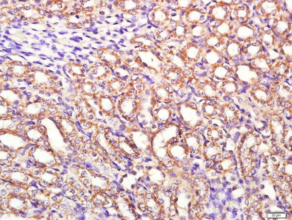 PI3KCA Antibody in Immunohistochemistry (Paraffin) (IHC (P))