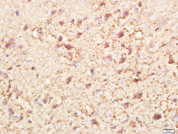 PI3KCA Antibody in Immunohistochemistry (Paraffin) (IHC (P))