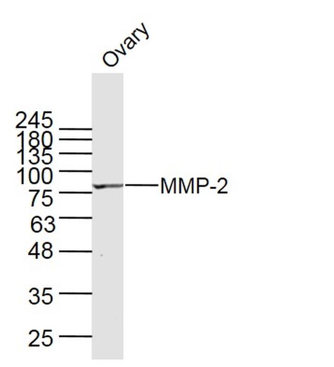 MMP2 Antibody in Western Blot (WB)