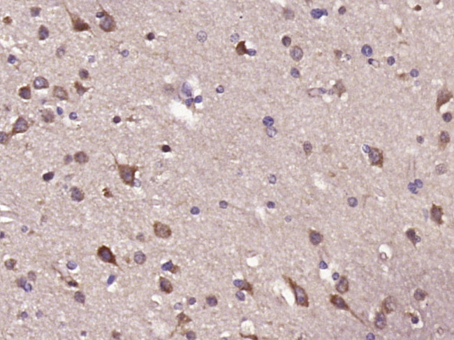 Dopamine D2 Receptor Antibody in Immunohistochemistry (Paraffin) (IHC (P))