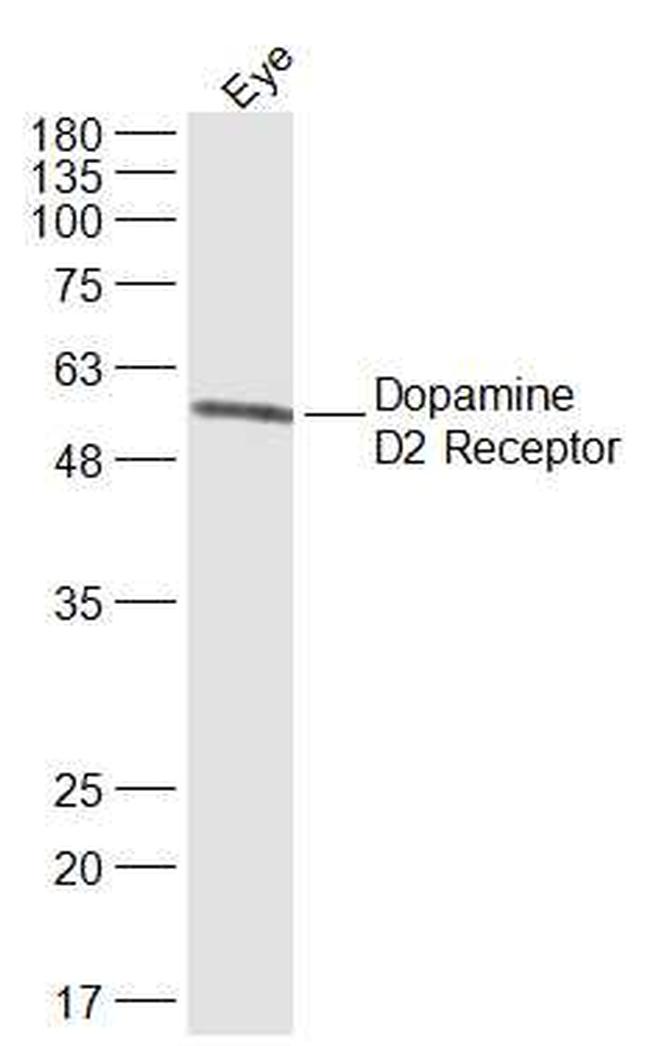 Dopamine D2 Receptor, Antibody in Western Blot (WB)