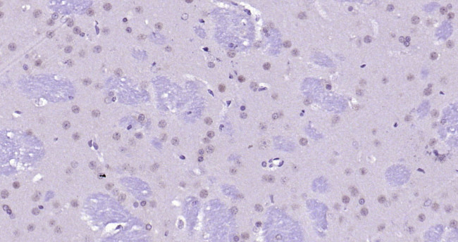 FAK Antibody in Immunohistochemistry (Paraffin) (IHC (P))