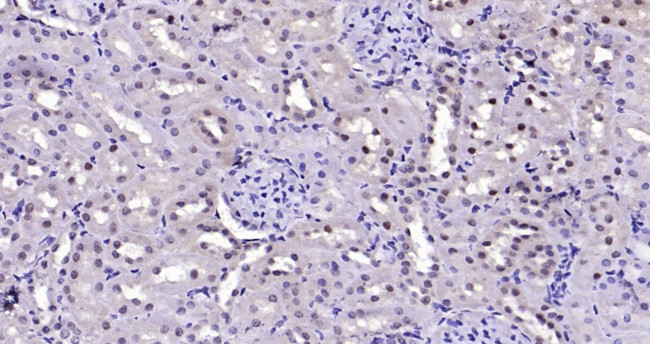 FAK Antibody in Immunohistochemistry (Paraffin) (IHC (P))