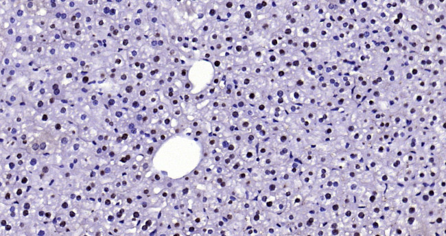 FAK Antibody in Immunohistochemistry (Paraffin) (IHC (P))