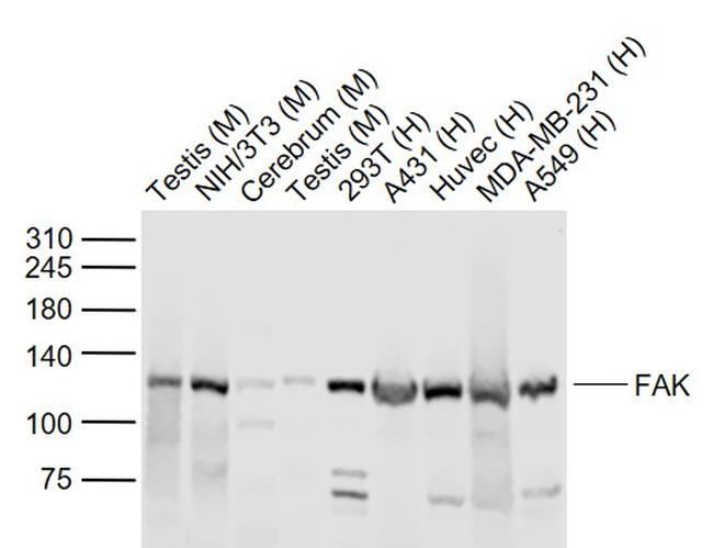 FAK Antibody in Western Blot (WB)