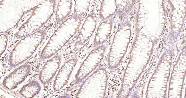 VEGF-C Antibody in Immunohistochemistry (Paraffin) (IHC (P))