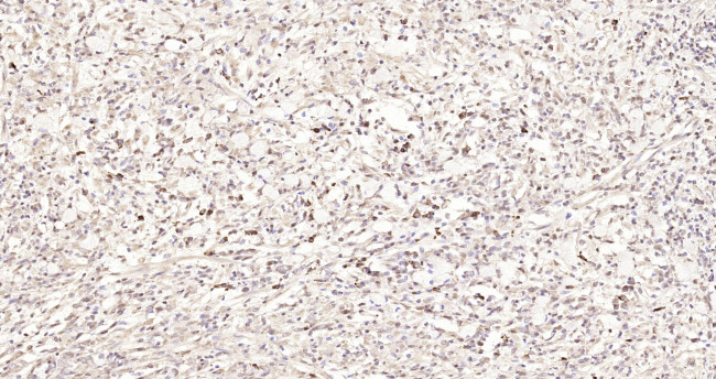 VEGF-C Antibody in Immunohistochemistry (Paraffin) (IHC (P))