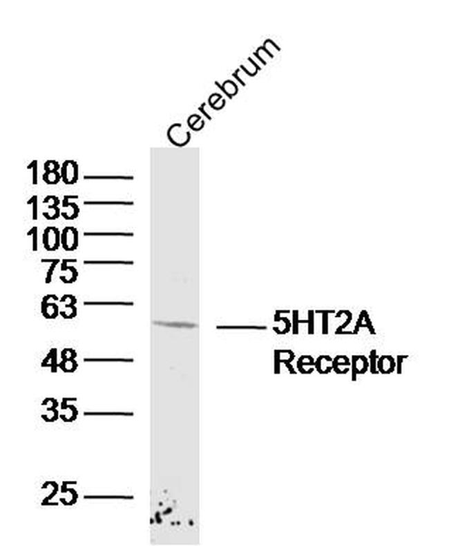 5HT2A Receptor Antibody in Western Blot (WB)