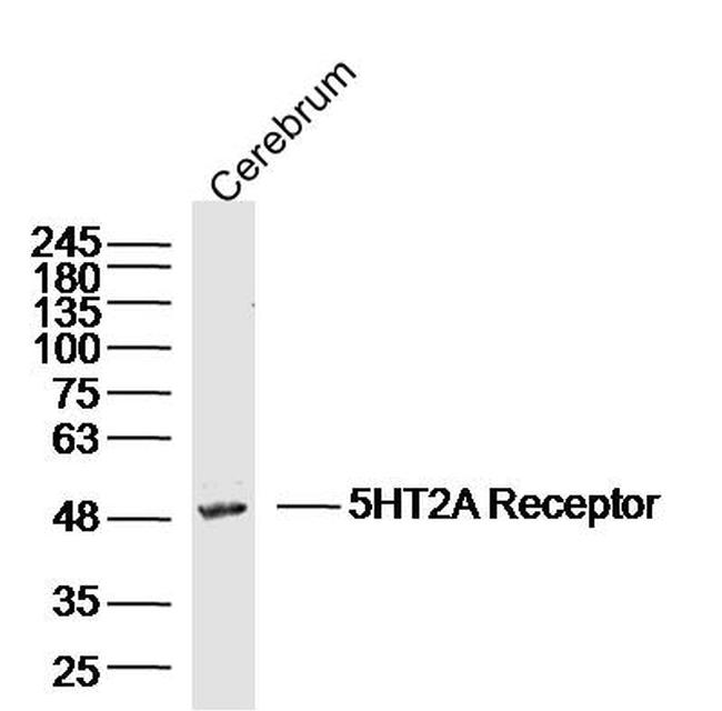 5HT2A Receptor Antibody in Western Blot (WB)