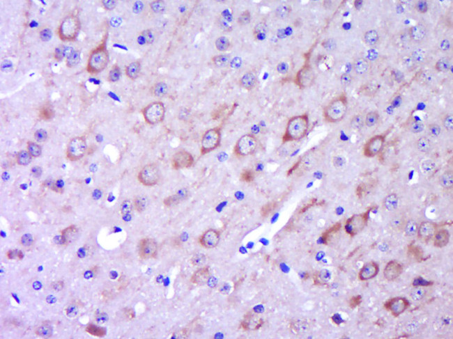 GPR49/LGR5 Antibody in Immunohistochemistry (Paraffin) (IHC (P))