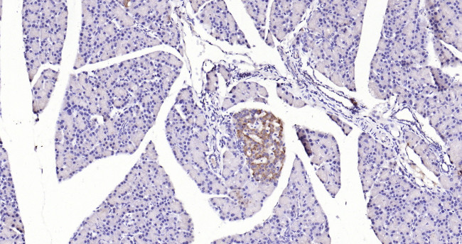 GPR49/LGR5 Antibody in Immunohistochemistry (Paraffin) (IHC (P))