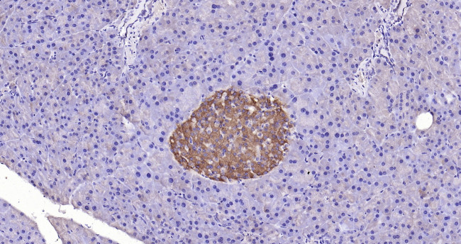 GPR49/LGR5 Antibody in Immunohistochemistry (Paraffin) (IHC (P))