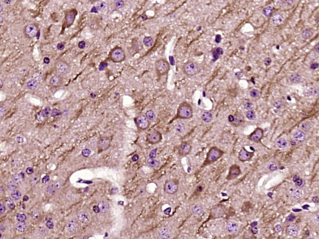 UCP-2 Antibody in Immunohistochemistry (Paraffin) (IHC (P))