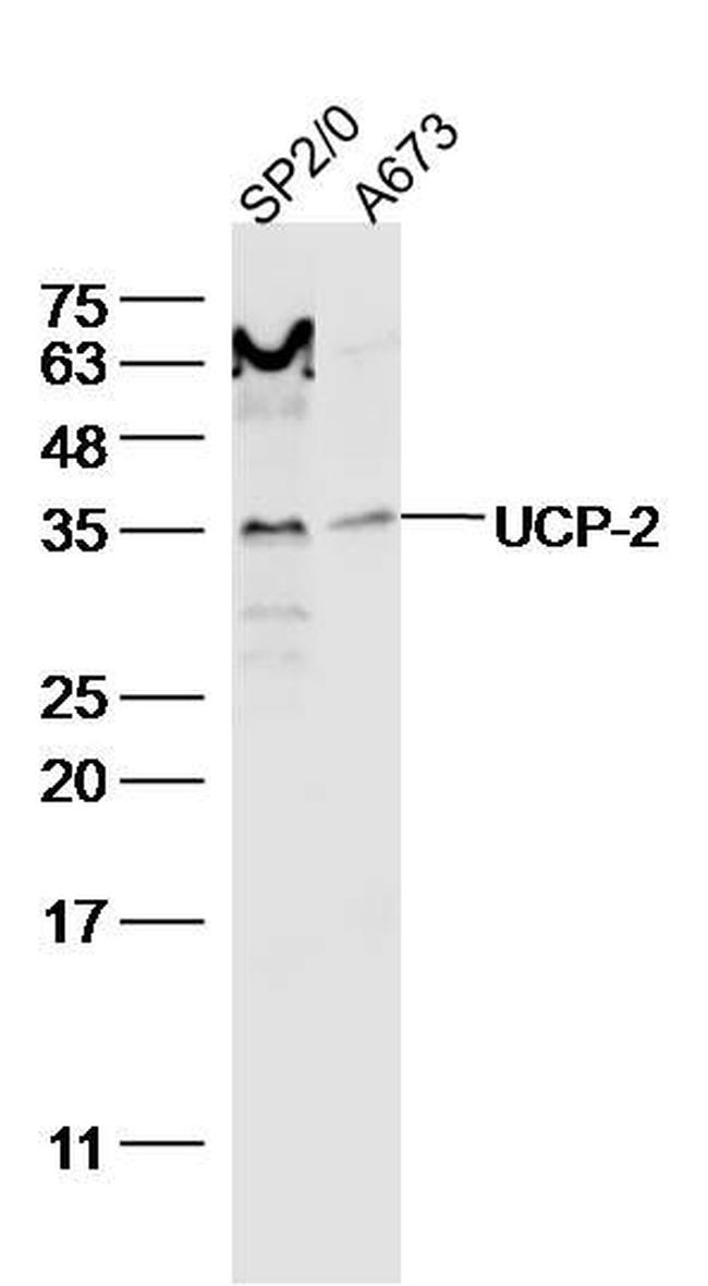 UCP-2 Antibody in Western Blot (WB)