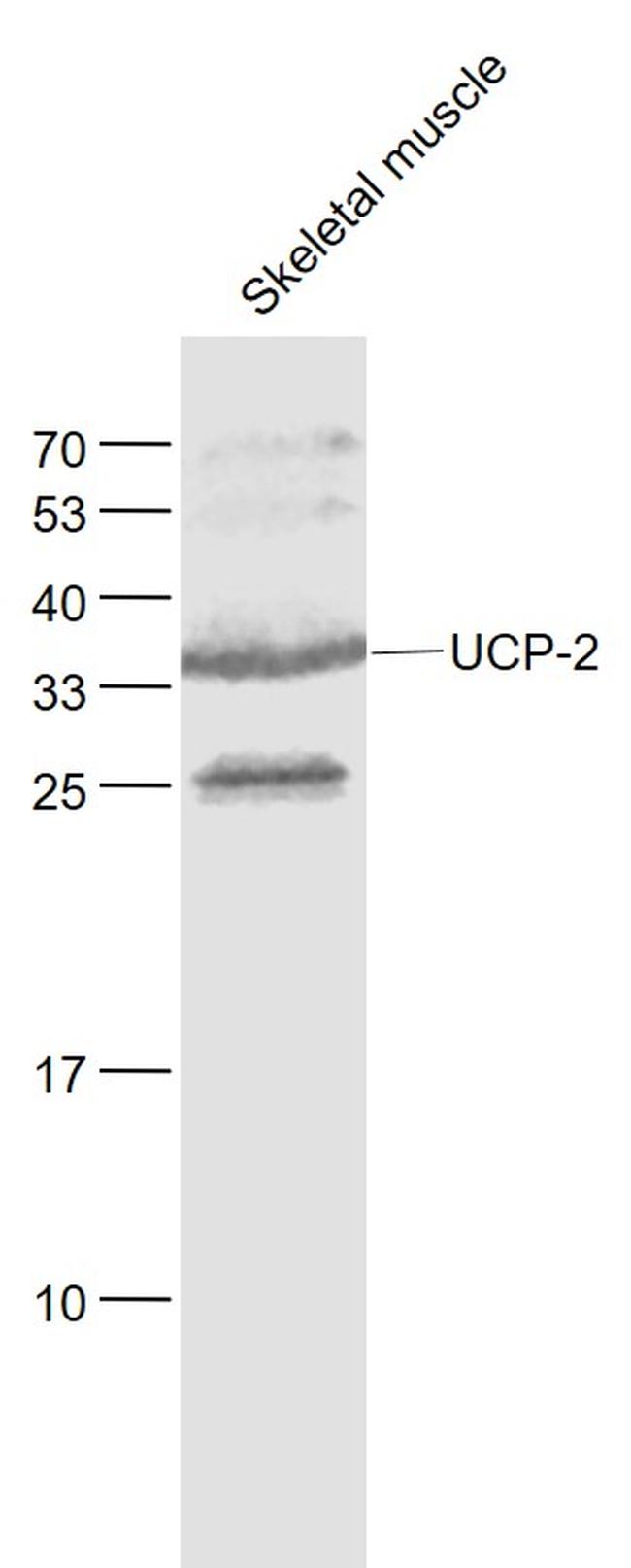 UCP-2 Antibody in Western Blot (WB)