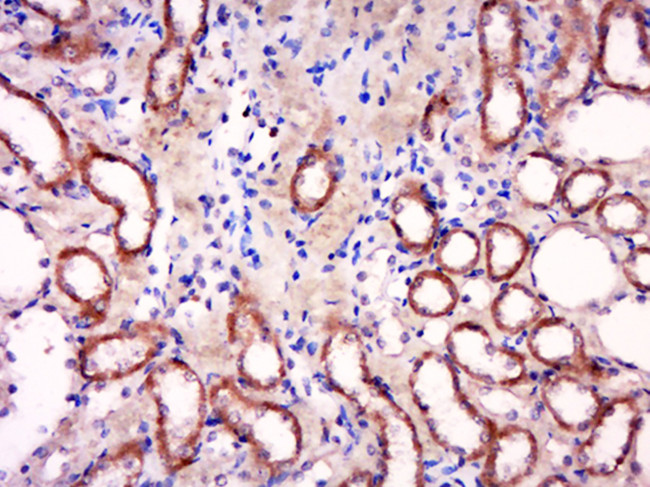 HTRA2 Antibody in Immunohistochemistry (Paraffin) (IHC (P))