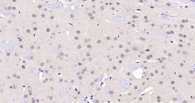 PARP1 Antibody in Immunohistochemistry (Paraffin) (IHC (P))